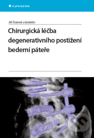 Chirurgická léčba degenerativního postižení bederní páteře-Jiří Donát